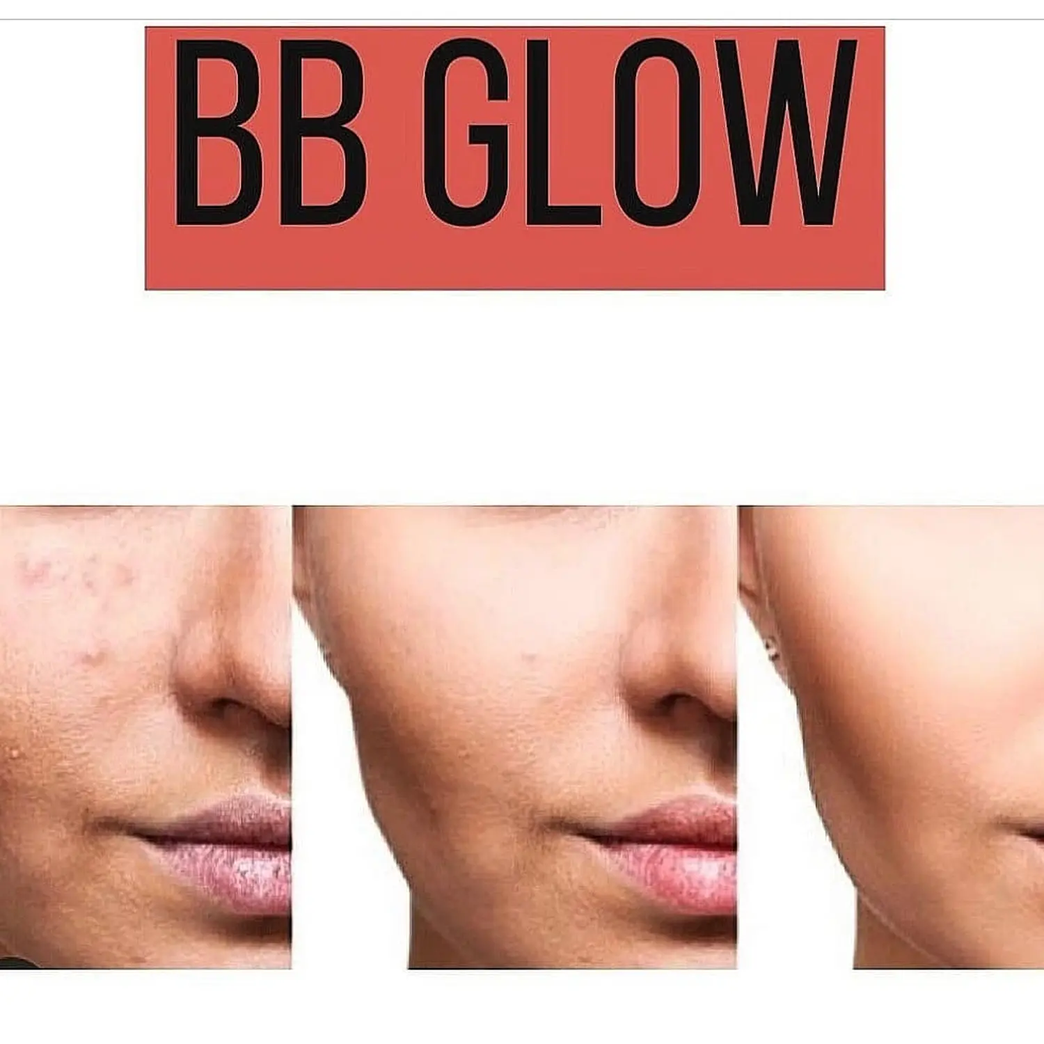 BB-Glow-Behandlung von Beautyconcept